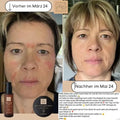 SKIN-LOVE - Wildrosen Serum mit Aloe Vera & Hyaluron Bio-Naturkosmetik 100m - VITALOVE - Naturprodukte