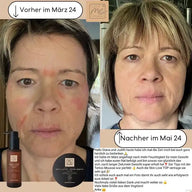 SKIN-LOVE - Wildrosen Serum mit Aloe Vera & Hyaluron Bio-Naturkosmetik 100m - VITALOVE - Naturprodukte