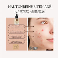HAUTUNREINHEITEN ADÉ - Klärendes Hautserum mit Hyaluron 15ml BIO-Naturkosmetik - VITALOVE - Naturprodukte